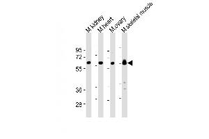 All lanes : Anti-Lyn Antibody (Center) at 1:2000 dilution Lane 1: mouse kidney lysates Lane 2: mouse heart lysates Lane 3: mouse ovary lysates Lane 4: mouse skeletal muscle lysates Lysates/proteins at 20 μg per lane. (LYN antibody  (AA 229-263))