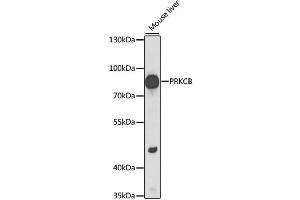 Western blot analysis of extracts of mouse liver, using PRKCB antibody (ABIN6290747) at 1:1000 dilution.