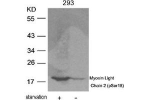 Image no. 2 for anti-Myosin, Light Chain 2, Regulatory, Cardiac, Slow (MYL2) (pSer18) antibody (ABIN319223) (MYL2 antibody  (pSer18))