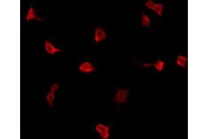 ABIN6276279 staining Hela by IF/ICC. (US28 antibody)