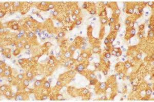 Immunohistochemistry of paraffin-embedded Human liver using FGB Polycloanl Antibody at dilution of 1:200 (Fibrinogen beta Chain antibody)