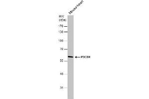 WB Image PDCD4 antibody detects PDCD4 protein by western blot analysis. (PDCD4 antibody)