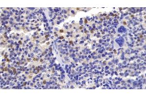 Detection of FceRI in Mouse Spleen Tissue using Polyclonal Antibody to Receptor I For The Fc Region Of Immunoglobulin E (FceRI) (Fc epsilon RI/FCER1A antibody  (AA 24-204))