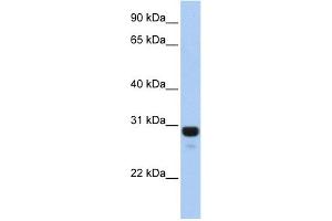 WB Suggested Anti-AMN1 Antibody Titration: 0. (AMN1 antibody  (N-Term))