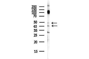 anti-Prostaglandin E Receptor 2 (Subtype EP2), 53kDa (PTGER2) (Internal Region) antibody