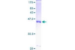 SOD1 Protein (AA 1-154) (GST tag)