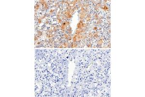 IHC testing of FFPE human adrenal gland tissue with VMAT2 antibody at 2. (SLC18A2 antibody)