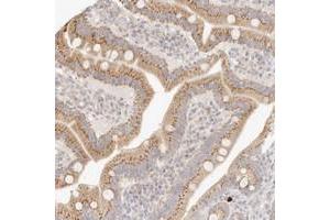 Immunohistochemical staining of human duodenum with FAM20B polyclonal antibody  shows granular cytoplasmic positivity in glandular cells.