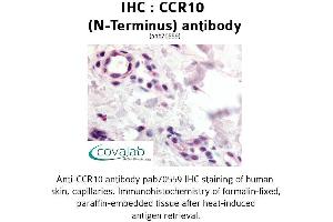 Image no. 1 for anti-Chemokine (C-C Motif) Receptor 10 (CCR10) (N-Term) antibody (ABIN1732760) (CCR10 antibody  (N-Term))