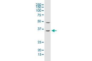 ARHGDIA monoclonal antibody (M02), clone 1G5-2F3. (ARHGDIA antibody  (AA 1-204))