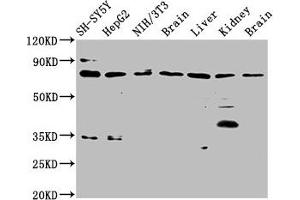 Western Blot Positive WB detected in: SH-SY5Y whole cell lysate, HepG2 whole cell lysate, NIH/3T3 whole cell lysate, Rat brain tissue, Rat liver tissue, Rat kidney tissue, Mouse brain tissue All lanes: CUX1 antibody at 3.