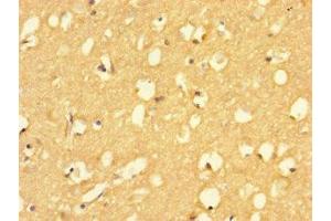 Immunohistochemistry of paraffin-embedded human brain tissue using ABIN7154600 at dilution of 1:100 (RIT2 antibody  (AA 1-150))