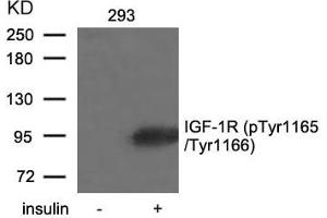 Western blot analysis of extracts from 293 cells untreated or treated with insulin using IGF-1R(Phospho-Tyr1165/Tyr1166) Antibody. (IGF1R antibody  (pTyr1165, pTyr1166))