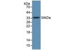 Detection of Recombinant C5a, Human using Monoclonal Antibody to Complement Component 5a (C5a) (C5A antibody  (AA 678-751))