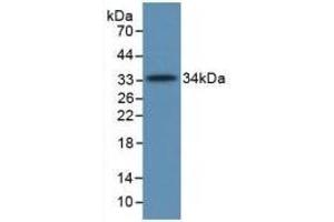 Detection of Recombinant C5a, Human using Monoclonal Antibody to Complement Component 5a (C5a) (C5A antibody  (AA 678-751))