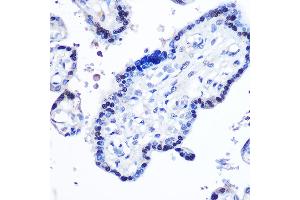 Immunohistochemistry of paraffin-embedded human placenta using STB Rabbit pAb (ABIN6133917, ABIN6148579, ABIN6148580 and ABIN6215957) at dilution of 1:100 (40x lens). (STAT5B antibody  (AA 1-100))