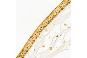Immunohistochemistry of paraffin embedded mouse eye using SLC7A14 (ABIN7075683) at dilution of 1:700 (400x lens) (SLC7A14 antibody)