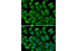 Immunofluorescence analysis of HeLa cell using DEFA1 antibody. (alpha Defensin 1 antibody)