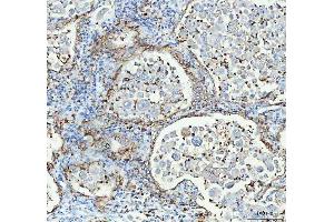 IHC analysis of Aquaporin 4 using anti-Aquaporin 4 antibody (ABIN3043789). (Aquaporin 4 antibody  (C-Term))