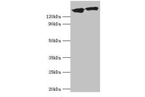 Western blot All lanes: DCTN1 antibody at 20 μg/mL Lane 1: Mouse brain tissue Lane 2: Jurkat whole cell lysate Secondary Goat polyclonal to rabbit IgG at 1/10000 dilution Predicted band size: 142, 128, 137, 139, 127, 141 kDa Observed band size: 142 kDa (Dynactin 1 antibody  (AA 1084-1278))