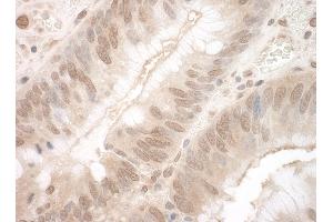 anti-Eyes Absent Homolog 3 (EYA3) (AA 1-30) antibody