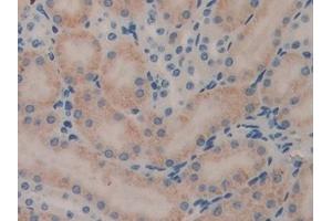 Detection of LEI in Mouse Kidney Tissue using Polyclonal Antibody to Leukocyte Elastase Inhibitor (LEI) (SERPINB1 antibody  (AA 184-368))