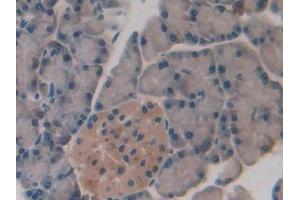 IHC-P analysis of Rat Pancreas Tissue, with DAB staining. (SLIT1 antibody  (AA 3-112))