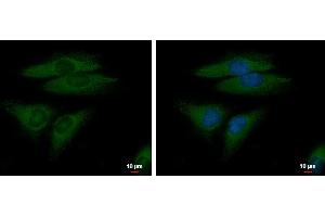ICC/IF Image FGFR-5 antibody detects FGFR-5 protein at cytoplasm by immunofluorescent analysis. (FGFRL1 antibody)