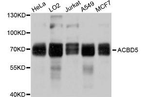 Western blot analysis of extracts of various cell lines, using ACBD5 antibody (ABIN5997181) at 1/1000 dilution. (ACBD5 antibody)