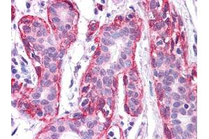Immunohistochemical analysis of paraffin-embedded human Breast tissues using FRK mouse mAb.