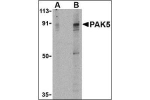 Western blot analysis of PAK5 in T24 lysate with this product at (A) 2 and (B) 4 μg/ml.