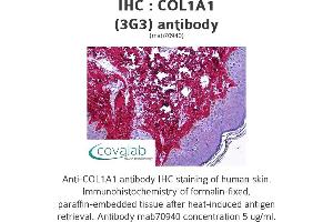 Image no. 1 for anti-Collagen, Type I, alpha 1 (COL1A1) (AA 1021-1108) antibody (ABIN1723789)