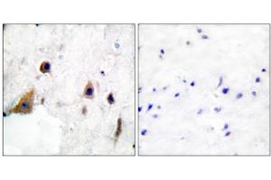 Immunohistochemical analysis of paraffin-embedded human brain tissue, using DARPP-32 (phospho-Thr75) antibody.