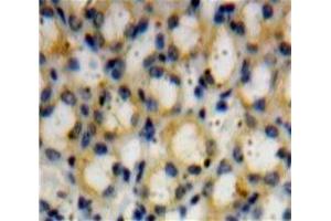Used in DAB staining on fromalin fixed paraffin-embedded Kidney tissue (ADAMTS1 antibody  (AA 258-467))