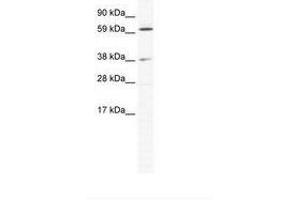 Image no. 1 for anti-ALX Homeobox 3 (ALX3) (N-Term) antibody (ABIN202290)