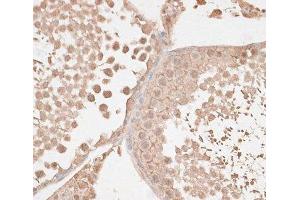 Immunohistochemistry of paraffin-embedded Rat testis using VEGF Receptor 2 Polyclonal Antibody at dilution of 1:100 (40x lens). (VEGFR2/CD309 antibody)