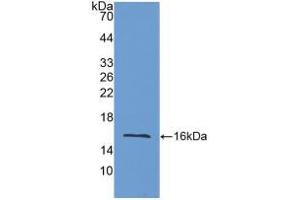 Western blot analysis of recombinant Mouse LOXL2.