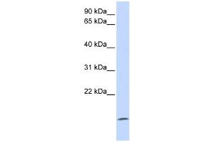 WB Suggested Anti-ZG16 Antibody Titration: 0.