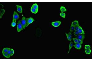 Immunofluorescent analysis of PC-3 cells cells using ABIN7175887 at dilution of 1:100 and Alexa Fluor 488-congugated AffiniPure Goat Anti-Rabbit IgG(H+L) (RPGR antibody  (AA 1-180))
