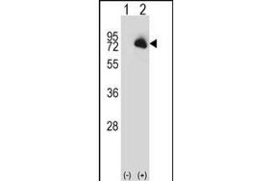 Western blot analysis of BTK (arrow) using rabbit polyclonal BTK Antibody (N-term) (ABIN657469 and ABIN2846497). (BTK antibody  (N-Term))