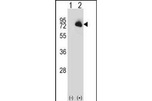 Western blot analysis of BTK (arrow) using rabbit polyclonal BTK Antibody (N-term) (ABIN657469 and ABIN2846497). (BTK antibody  (N-Term))