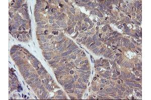 Image no. 1 for anti-Tripartite Motif Containing 38 (TRIM38) (AA 1-265) antibody (ABIN1490680) (TRIM38 antibody  (AA 1-265))