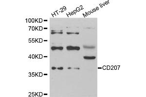 Western blot analysis of extracts of various cell lines, using CD207 antibody (ABIN5973934) at 1/1000 dilution. (CD207 antibody)
