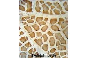 DHRS7 Antibody (N-term) (ABIN650968 and ABIN2840014) immunohistochemistry analysis in formalin fixed and paraffin embedded human skeletal muscle followed by peroxidase conjugation of the secondary antibody and DAB staining. (DHRS7 antibody  (N-Term))