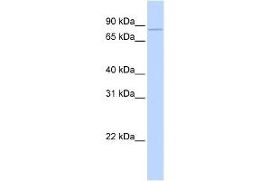 WB Suggested Anti-CPEB3 Antibody Titration: 0. (CPEB3 antibody  (Middle Region))