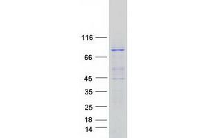 Validation with Western Blot (EXOC3 Protein (Myc-DYKDDDDK Tag))