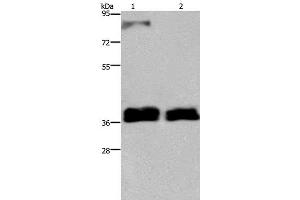 Western Blot analysis of 231 and A172 cell using FETUB Polyclonal Antibody at dilution of 1:700 (FETUB antibody)
