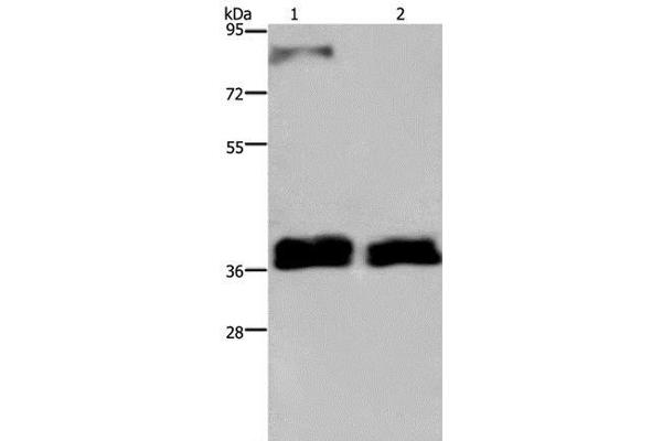 FETUB antibody