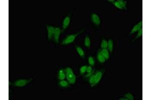 Immunofluorescent analysis of Hela cells using ABIN7154810 at dilution of 1:100 and Alexa Fluor 488-congugated AffiniPure Goat Anti-Rabbit IgG(H+L) (DKC1 antibody  (AA 94-170))