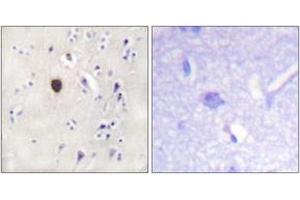 Immunohistochemistry analysis of paraffin-embedded human brain tissue, using Kir6. (KCNJ11 antibody  (AA 190-239))